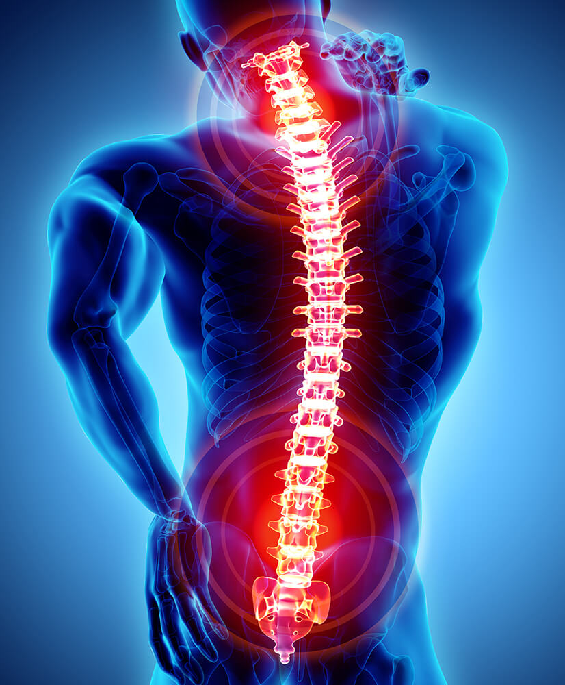 illustration of human body with spine outlined in red to show spinal pain